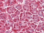 AP22812PU-N - Caspase-12