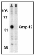 AP22812PU-N - Caspase-12