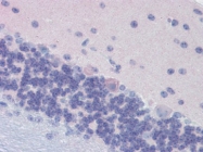 AP22815PU-N - G protein alpha 0