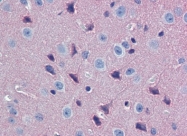 AP22815PU-N - G protein alpha 0
