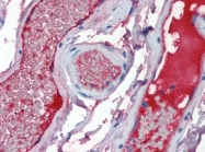 AP22817PU-N - von Willebrand factor (VWF)