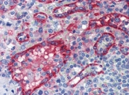 AP22817PU-N - von Willebrand factor (VWF)