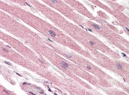 AP22861PU-N - Caspase-1