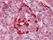 AP22861PU-N - Caspase-1