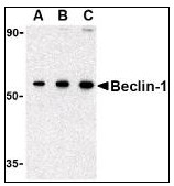 AP22864PU-N - Beclin-1