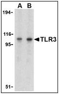 AP22865PU-N - CD283 / TLR3