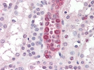 AP22870PU-N - Cyclooxygenase 1