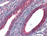 AP22872PU-N - Endoplasmin / HSP90B1 / TRA1