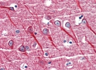 AP22878PU-N - CD120a / TNFR1