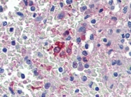 AP22888PU-N - Heme oxygenase 1 / HMOX1