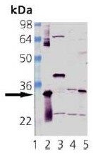 AP22888PU-N - Heme oxygenase 1 / HMOX1