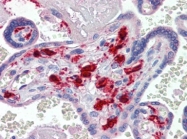 AP22898PU-N - Coagulation factor XIIIa (F13A1)