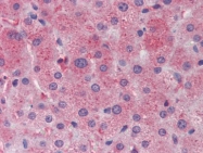 AP22902PU-N - Apolipoprotein C III / ApoC3
