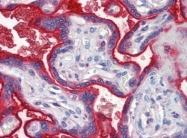 AP22902PU-N - Apolipoprotein C III / ApoC3