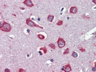 AP22903PU-N - Neuronal acetylcholine receptor subunit alpha-7