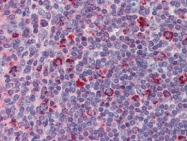 AP22905PU-N - TYROBP / DAP12