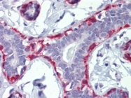 AP22906PU-N - Calponin-1