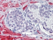 AP22906PU-N - Calponin-1