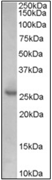 AP23041PU-N - CDKN1B / KIP1
