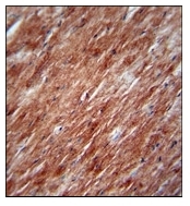 AP17501PU-N - Interleukin-2 / IL2