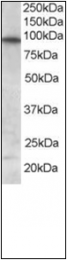 AP23030PU-N - FOXO3 / FKHRL1