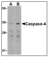 AP22937PU-N - Caspase-4