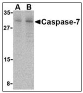 AP22940PU-N - Caspase-7