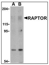 AP22943PU-N - RAPTOR
