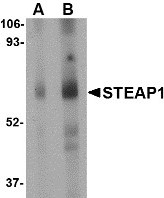 AP22946PU-N - STEAP / STEAP1