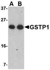 AP22947PU-N - GSTP1 / GST3