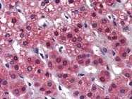 AP22948PU-N - Calcyphosin-2