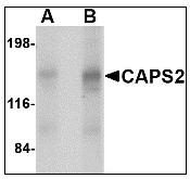 AP22948PU-N - Calcyphosin-2