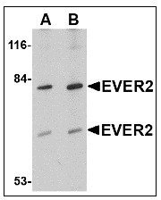 AP22949PU-N - TMC8