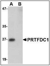 AP22950PU-N - PRTFDC1