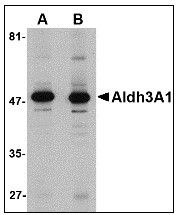 AP22952PU-N - ALDH3