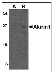 AP22955PU-N - AKIRIN1