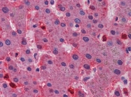 AP22957PU-N - Hemopexin / HPX