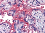 AP22957PU-N - Hemopexin / HPX