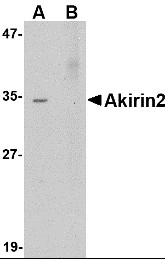 AP22976PU-N - AKIRIN2 / C6orf166