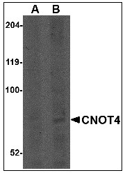AP22977PU-N - CNOT4