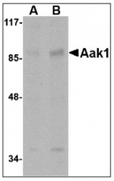 AP22978PU-N - AAK1