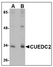 AP22985PU-N - CUEDC2