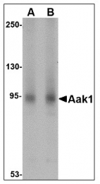 AP22987PU-N - AAK1