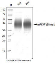 AR26011PU-S - Placenta growth factor / PGF