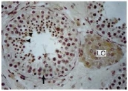AP02091PU-S - Endothelin 1+2