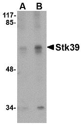 AP22996PU-N - STK39 / SPAK