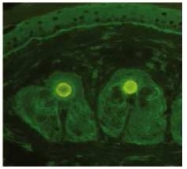 AP23436PU-N - Collagen type VII