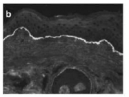 AP23438PU-N - Collagen type VII