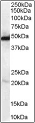 AP23025PU-N - NDRG1