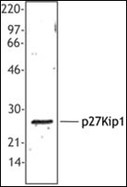 AP23020PU-N - CDKN1B / KIP1